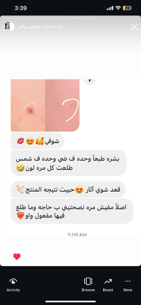 مرهم حب الشباب de la cruz